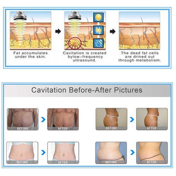 skin-tightening-ultrasonic-cavitation-40k-fat-burning-weight-loss-instrument-zgad