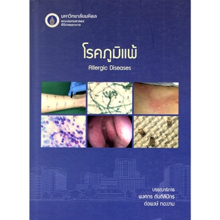 c111 9786168201114 โรคภูมิแพ้ (ALLERGIC DISEASES)