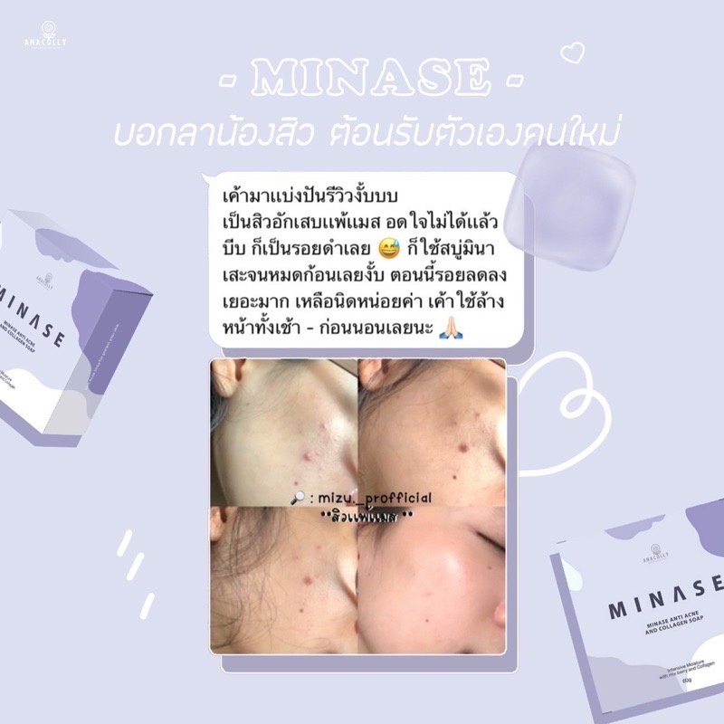 สบู่-minase-รักษาสิว-สบู่คอลลาเจน-collagen-berry-soap-หน้าใสไร้สิว-สบู่-ขนาด-60-g-ผิวใส-สินค้าพร้อมส่ง-ยอดฮิต