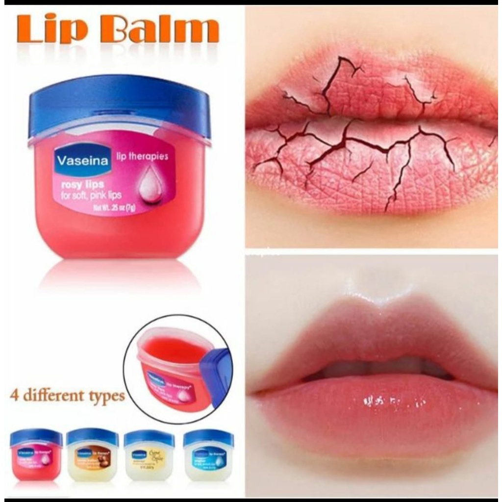 ภาพสินค้าVaseline Lip Therapy Origina 7g ลิป วาสลีน สุดฮิต ริมฝีปากนุ่ม น่าจูบส์ พร้อมส่ง ดีงามมาก เทอราพี ช่วยดูแลริมฝีปาก จากร้าน shopmolly บน Shopee ภาพที่ 3