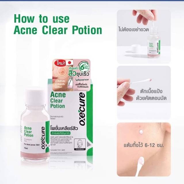 oxe-cure-acne-clear-potion-อ๊อกซีเคียว-แอคเน่-เคลียร์-โพชั่น-แต้มสิว-รักษาสิว-บำรุงผิวหน้า-ขนาด-15-ml-1-ขวด