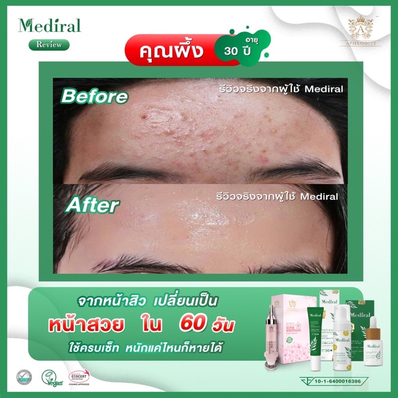 ส่งฟรี-mediral-โปรโมชั่นพิเศษ-3-แถม-4-มูส-3-เซรั่ม-2-กันแดด-2-สูตรแพทย์