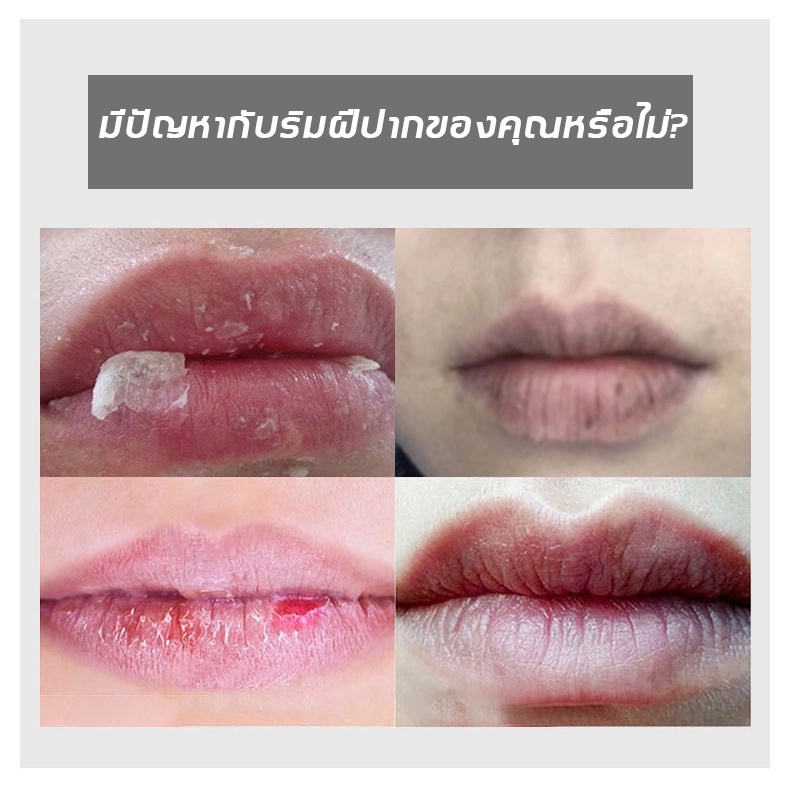 ลดกระหน่ำ-ลิปบาล์ม-50g-ปากอมชมพู-ลิปแก้ปากดำ-ครีมแก้ปากดำ-ลิปมันบำรุงปาก-ลิปแก้ปากคล้ำ-lip-balm