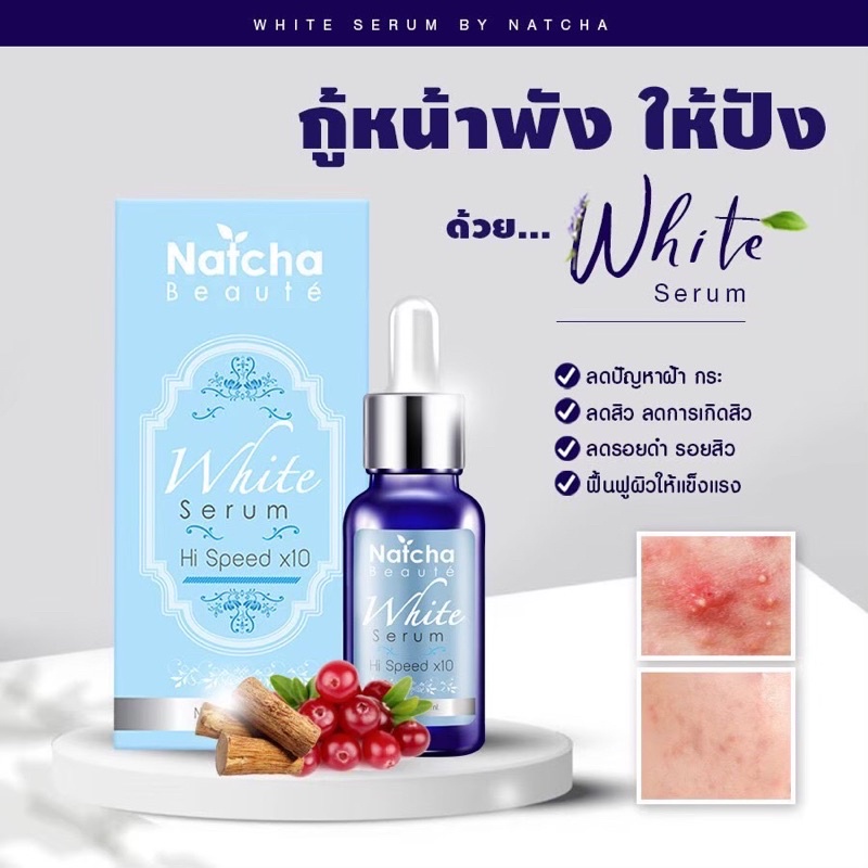 เซรั่มณัชชา-natcha-serum-ของแท้100-ร้านนี้ส่งฟรี-มีของแถม