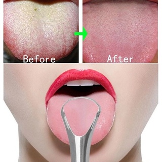 ที่ขูดลิ้น ที่มีประโยชน์ สเตนเลส ทําความสะอาดลิ้นปาก ทางการแพทย์ แปรงปาก ใช้ซ้ําได้ ดูแลช่องปาก เครื่องมือสุขอนามัย โลหะ