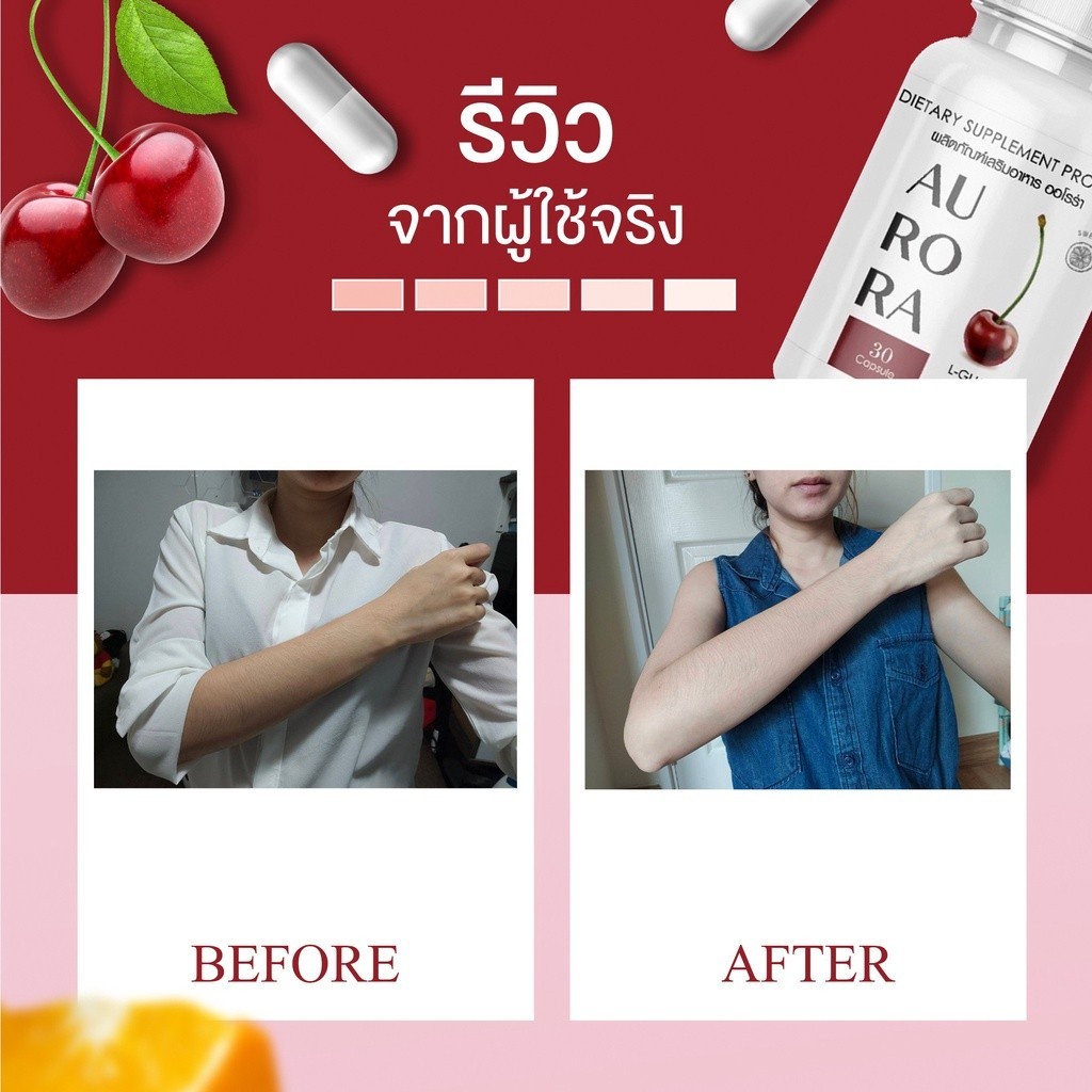 กลูต้าออโรร่า-aurora-30-แคปซูล