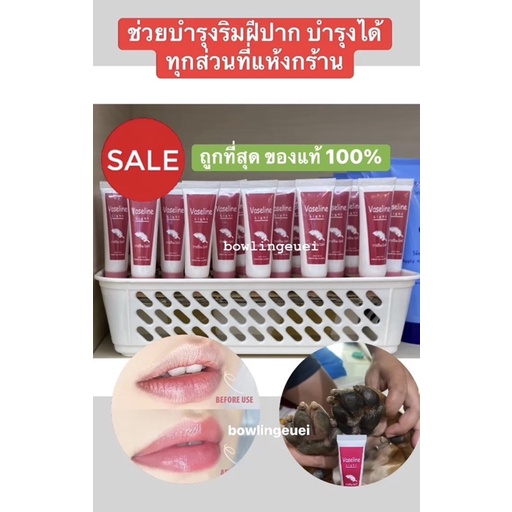 vaseline-light-วาสลีนไลท์-ยาตำหรับศิริราช-วาสลีนบำรุงริมฝีปาก-แก้ปากแตก-แก้ปากคล้ำ-ยาศิริราช