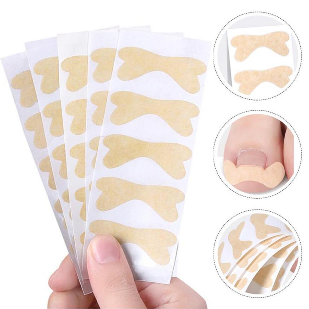 expen-waterproof-ingrown-toenails-stickers-decals-pedicure-tools-toenail-treatment-corrector-stickers-recovery-corrector-paronychia-for-toe-decals-25pcs-pedicure-patch-pedicure-sticker-nail-care-patch