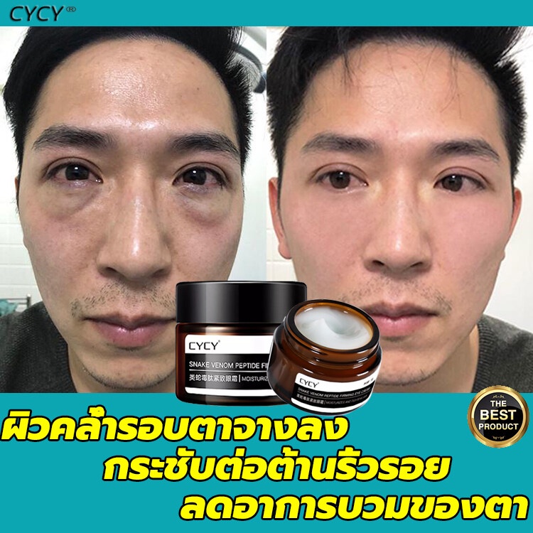 cycyครีมบำรุงรอบดวงตา-ลดความหมองคล้ำและริ้วรอย-ครีมลบริ้วรอย-ครีมต่อต้านริ้วรอย-ครีมลดริ้วรอยรอบดวงตา-เซรั่มบำรุงรอบดวงต