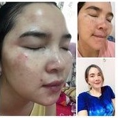 ครีมโบวี่คิ้ม-bowvy-kim-ลดสิว-ฝ้า-ผิวหมองคล้ำ-ให้ขาวกระจ่างใสแท้10000