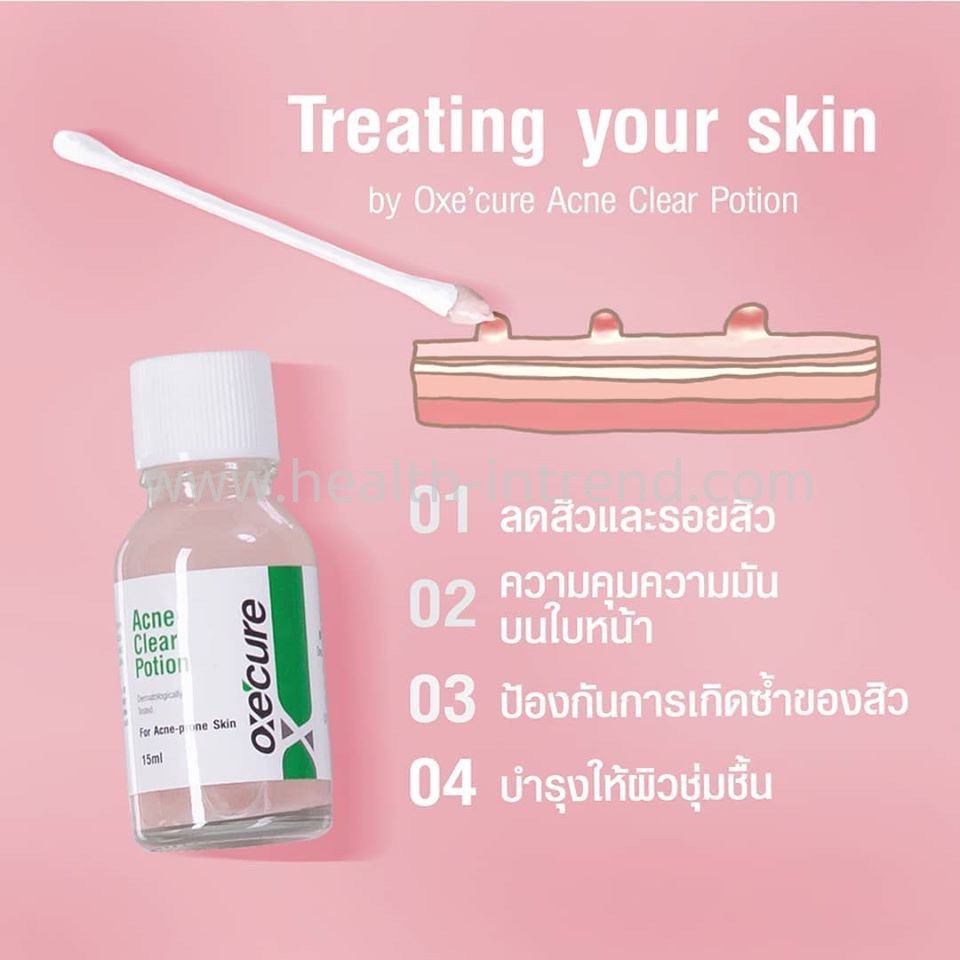 oxe-cure-acne-clear-power-mud-แป้งโคลนเคลียร์สิวตัวดัง-oxecure