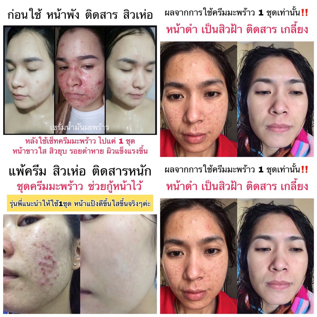 สุดคุ้มเซต-5-ชิ้น-ส่งฟรีด้วยนะ-coconut-episode-secret-เซตหน้ามะพร้าว-บำรุงทุกขั้นตอน-โสมมะพร้าว-โลชั่นทาวตัว