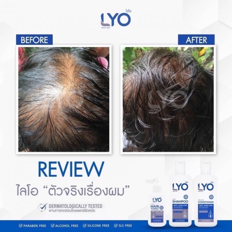 ภาพสินค้าส่งฟรี LYO ไลโอ หนุ่มกรรชัย  ไลโอแชมพู ไลโอแฮร์โทนิค lyo shampoo lyo hair tonic แชมพูแก้ผมร่วง จากร้าน chennnnn1 บน Shopee ภาพที่ 6