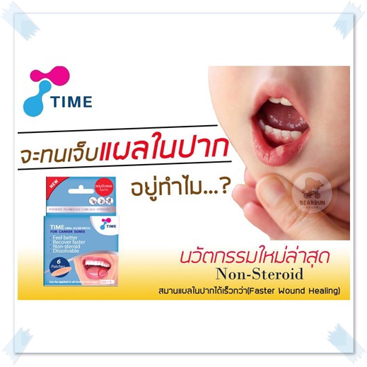 ภาพสินค้าTime Oral Ulcer Patch แผ่นปิดแผลในปาก (1ซอง มี2ชิ้น) ละลายในปาก รักษาร้อนใน จากร้าน bearrun.1 บน Shopee ภาพที่ 3