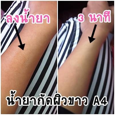 เจลกัดผิวขาวa4white-ขนาดใหญ่-500-มล-น้ำยากัดผิวขาวถาวร-ผลัดเซลล์ผิวขาว-ขนาดใหญ่-500-มล-กำจัดทุกความดำเพียง-3-นาที