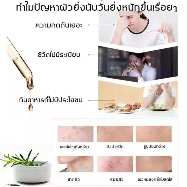 ครีมลดสิว-สิวอักเสบ-มีประสิทธิภาพและเร็ว-ไม่เป็นซ้ำ-อ่อนโยน-ปลอบประโลมและซ่อมแซม-สิว-สิว-กำจัดสิว-ครีมกำจัดสิว-ครีมลดสิ