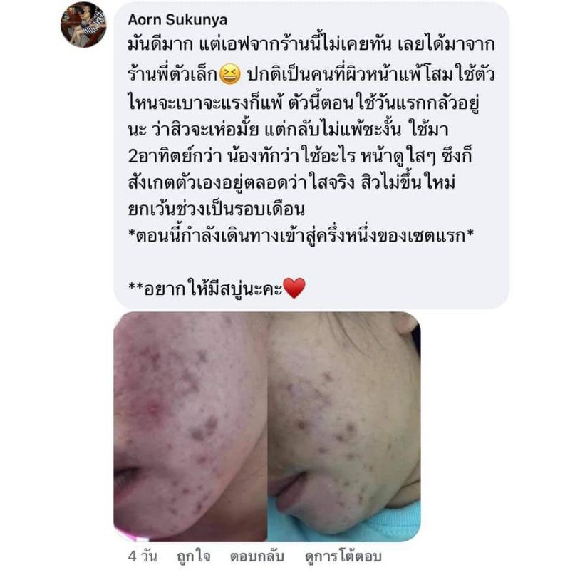 พร้อมส่ง-sm-skin-me-เซ็ตคู่-จบทุกปัญหาผิวหน้า