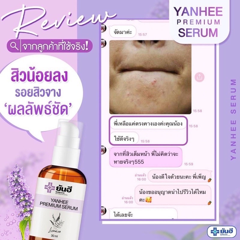 เซรั่มของแท้-รพ-ยันฮี-yanhee-serum-ยันฮีพรีเมี่ยมเซรั่ม-yanhee-premium-serum-ยันฮีเซรั่ม-ลดฝ้า-กระ-จุดด่างดำ-สิว