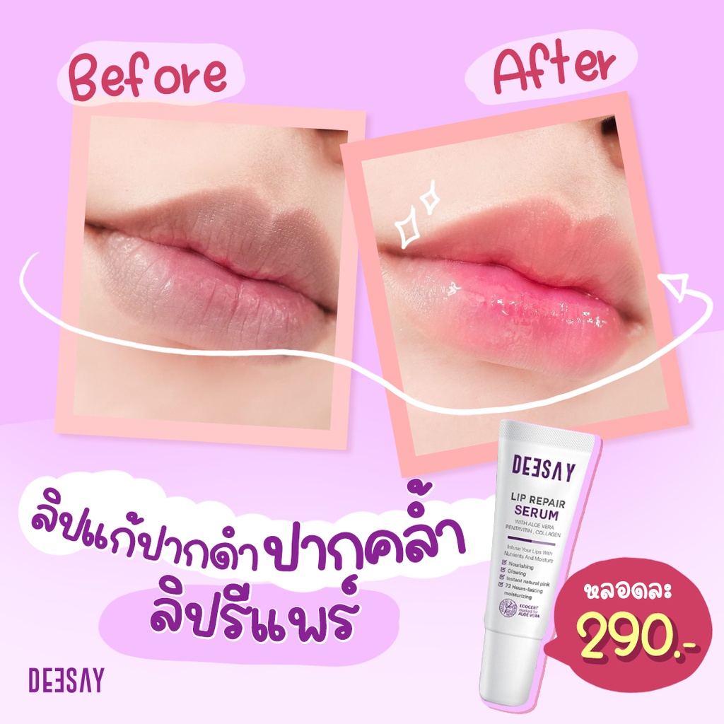 ภาพสินค้าDeesay Lip Repair Serum ส่งฟรี ของแท้จากบริษัทแบรนด์ ลิปแก้ปากดำ บำรุงริมฝีปาก ลิปสักปาก ลิปรีแพร์ จากร้าน hb.onlineshop บน Shopee ภาพที่ 4