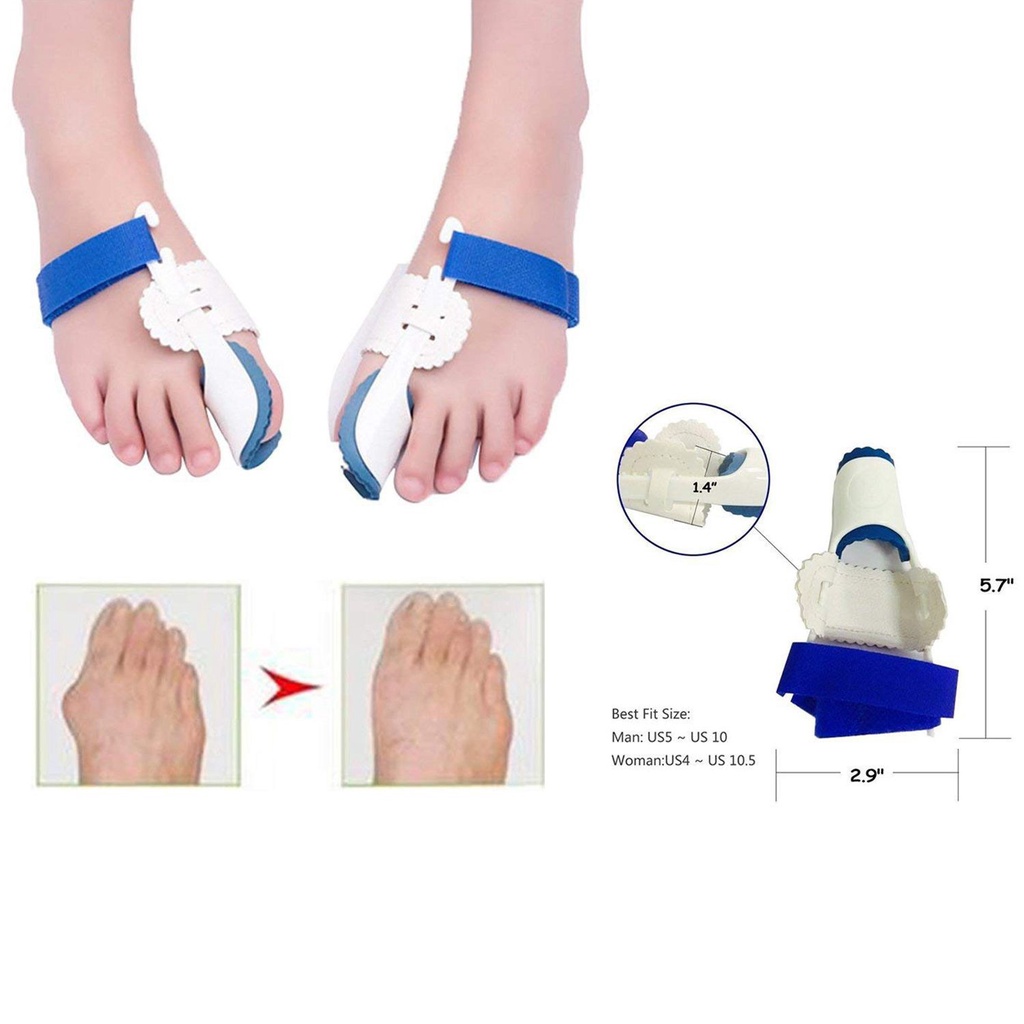 ภาพหน้าปกสินค้าBunion Corrector and Bunion Relief Kit - Cure Pain in Big Toe Joint,Tailors Bunion, Hallux Valgus,Hammer Toe, Toe Separators Spacers Straighteners Splint Aid Surgery Treatment จากร้าน dizhong2.th บน Shopee