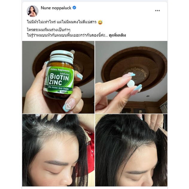 biotin-zinc-90-เม็ด-ไบโอทิน-ซิงก์-คณะเภสัช-จุฬา-บำรุงผม-ผิว-เล็บ