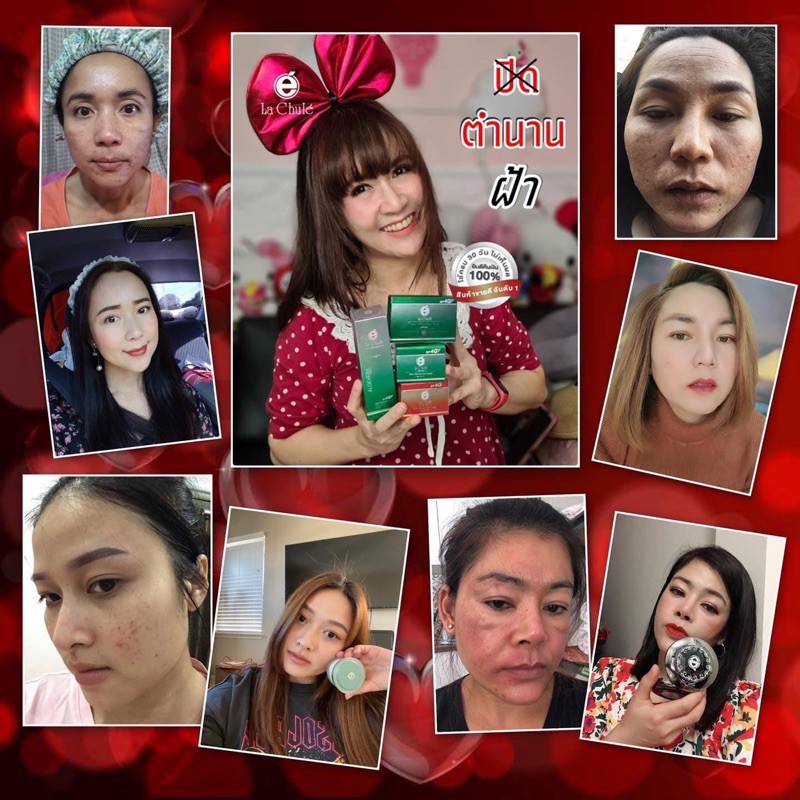 สมัครสมาชิกฟรี-พร้อมรับส่วนนลด20-ทันที-ลาชูเล่-lachule-ชุดไบร์ทบล็อคเซ็ท-ชุดรักษากระ-ฝ้า-หน้าขาวใส-ครบจบเรื่องฝ้า