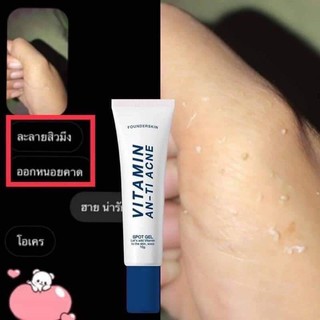 Founderskin Vitamin An-ti Acne  ฟาวเดอร์ เจลละลายสิว