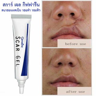 ถูก ดี ของแท้-พร้อมส่ง สการ์เจลScar Gelเจลลบรอยแผลเป็น รอยดำ รอยสิว/ปริมาณ15กรัม/จำนวน1หลอด/รหัส14005🌺2Xpt