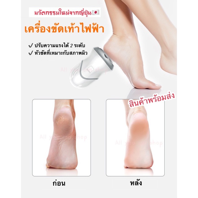 เครื่องขัดส้นเท้าไฟฟ้า-เครื่องขัดส้นเท้าแตก-รักษาส้นเท้าแตก