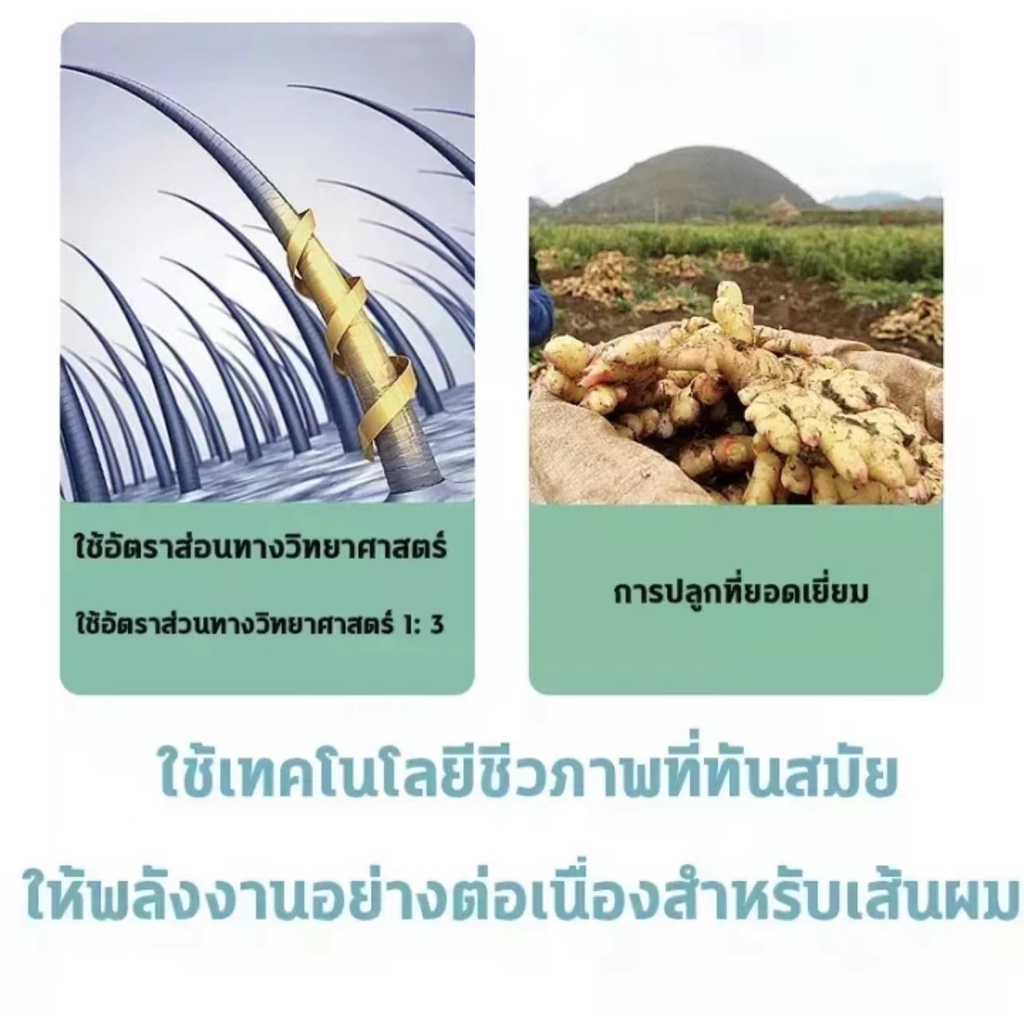 oushlian-ยาสระผมรังแค-ทำความสะอาดล้ำลึก-ขจัดรังแคไร-รูขุมขนอักเสบอย่างได้ผล-ทำให้หนังศีรษะสบายขึ้น-แชมพูขจัดรังแค