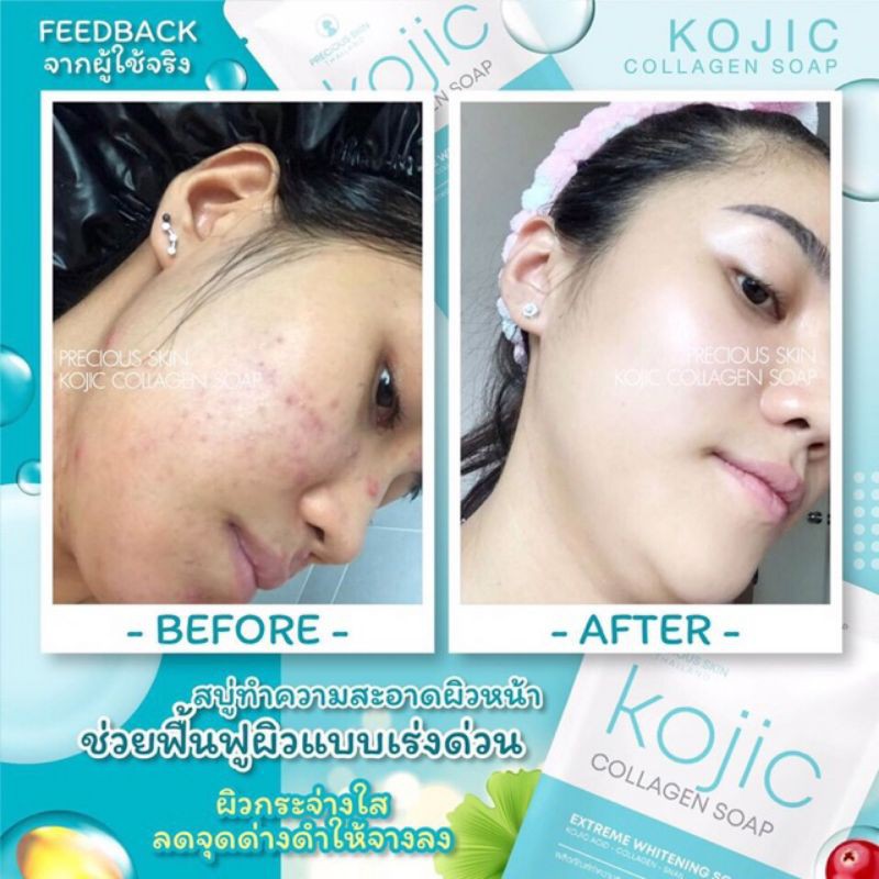 kojic-collagen-soap-สบู่โคจิก