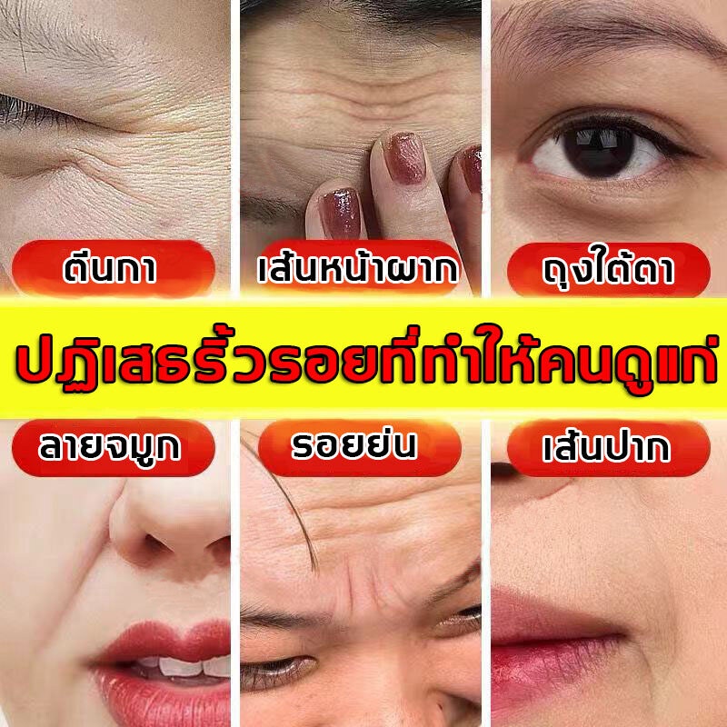 eelhoe-ครีมลบริ้วรอย-50ml-ลดรอยตีนกา-ร่องแก้ม-ริ้วรอยหน้าผาก-ขจัดความหมองคล้ำ-ยกกระชับ-ทำให้ผิวเรียบเนียนยืดหยุ่น-ครีมลดริ้วรอย-ครีมหน้าขาวใส-ครีมต่อต้านริ้วรอย-รีมลบริ้วรอย-ครีมริ้วรอย-ครีมทารอบดวงตา