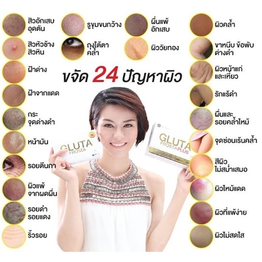 gluta-frosta-plus-กลูต้า-ฟรอสต้า-พลัส-อาหารเสริมผิวขาว-30-เม็ด