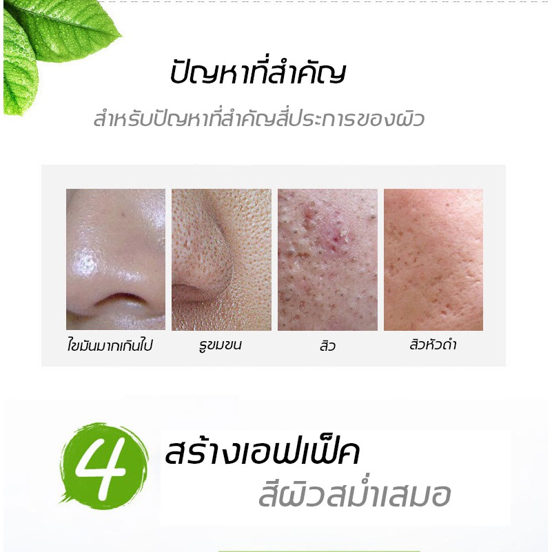 aichunครีมลบรอยดำสิว30mlรักษาสิวอย่างล้ำลึก-ซ่อมแซมรอยสิวและหลุมสิว-ครีมลดรอยสิว-ครีมแต้มสิว-เซรั่มกำจัดสิว-ครีมกำจัดสิว