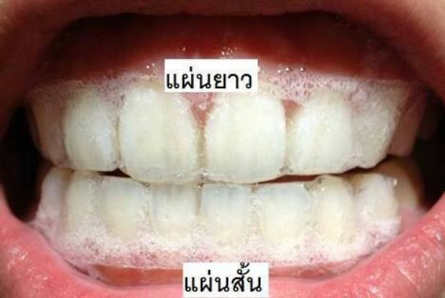 แผ่นฟอกฟันขาว-ของแท้-แผ่นแปะฟันขาว-crest-3d-white-luxe-professional-effects-แผ่นฟอกฟัน-crest-ฟอกฟันขาว-แผ่นแปะฟัน