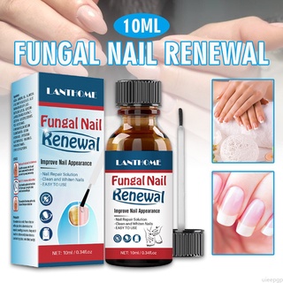 สินค้า 10ml Fungal Nail Renewal Extra Strength Nail Fungus Treatment Liquid uieepgp