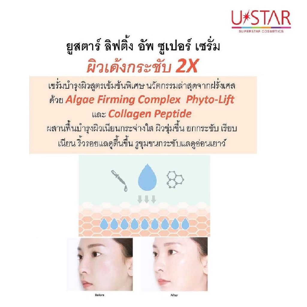 ustar-lifting-up-super-serum-03018-ยูสตาร์-ลิฟติ้ง-อัพ-ซูเปอร์-เซรั่ม-กระชับผิว-x-1-ชิ้น-beautybakery