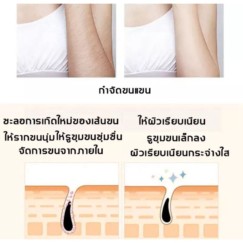 มูสกำจัดขนถาวร-120ml-มูสกำจัดขน-สเปรย์กำจัดขน-กำจัดขนขา-กำจัดขนรักแร้-กำจัดขนขา-กำจัดขนรักแร้-กำจัดขนน้องสาว