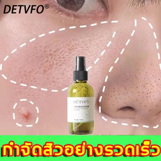 DETVFOครีมรักษาสิว120mlรักษาสิวเสี้ยน（เซรั่มลดสิว ครีมแต้มสิว เจลรักษาสิว เจลแต้มสิว ครีมลดสิว เซรั่มหน้าใส )