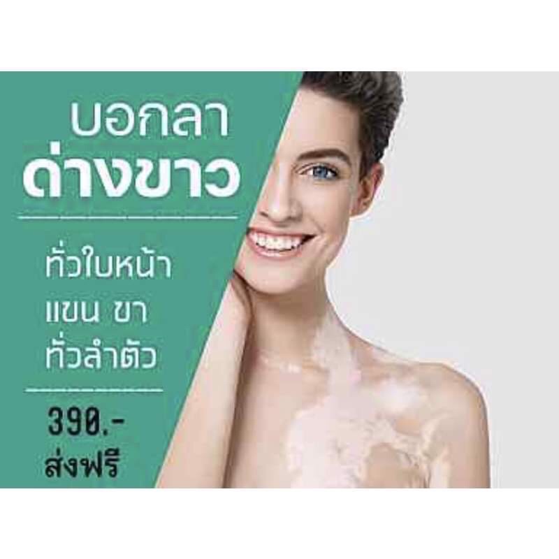 ผิวด่างขาวครีมสมุนไพรจีน-vitiligo-health-cream-ช่วยได้