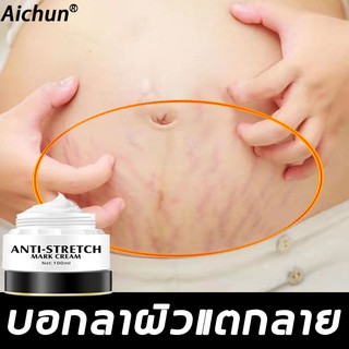 Aichun ครีมท้องแตกลาย 100ml พัฒนาขึ้นเป็นพิเศษสำหรับหญิงตั้งครรภ์ คืนความยืดหยุ่นให้กับผิว ครีมทาท้องลาย ครีมกันแตกลาย