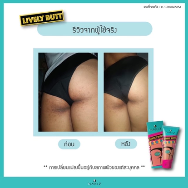 ส่งฟรี-nakiz-lively-butt-ครีมลดบั้นท้ายดำ-ขาหนีบดำ-รักแร้ดำ-หัวเข่าดำ-ข้อศอกดำ