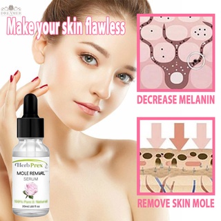 【DREAMER】20ml Mole Removal Cream Essential Oil Organic Tags Solutions Skin Tag Mole Freckle Spot Fast Remover Skin Care