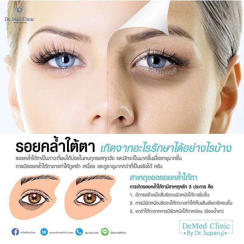 demed-ผลิตภัณฑ์ดูแลฝ้า-กระ-จุดด่างดำ-สุดพิเศษที่demed