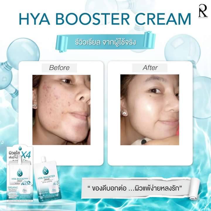 ratcha-hya-booster-cream-รัชชา-ไฮยา-บูสเตอร์-ครีม-ปริมาณสุทธิ-7กรัม-1-กล่อง-10-ซอง