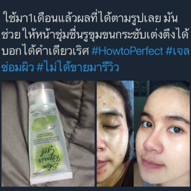 เจลซ่อมผิว-erika-ลดสิว-ฟื้นฟูผิวสูตรบำรุงล้ำลึก