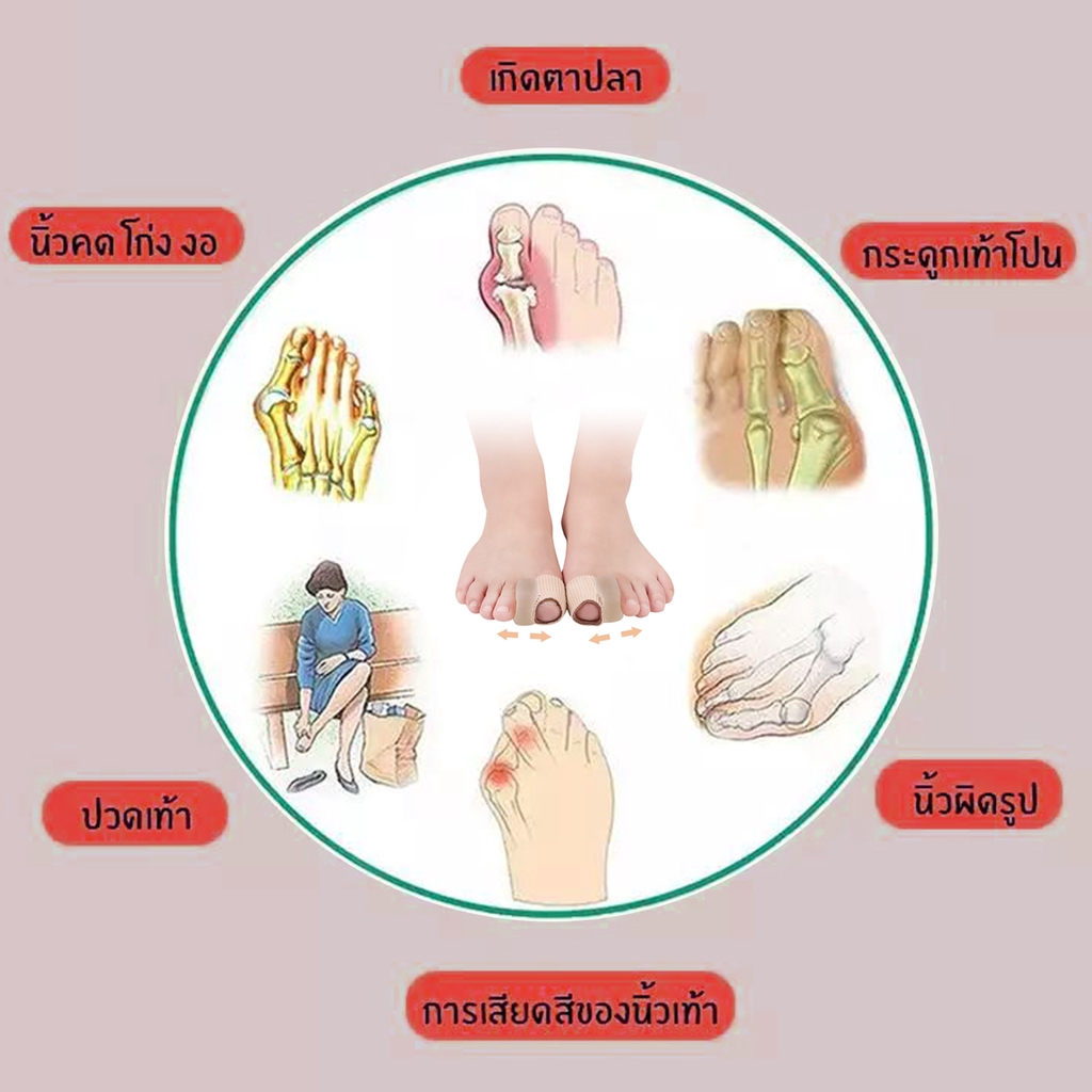 เฝือกซิลิโคน-ใส่คั่นนิ้วเท้า-ป้องกันอาการบาดเจ็บ-ลดแรงกระแทก-1-คู่-นิ้วโป้ง-นิ้วชี้