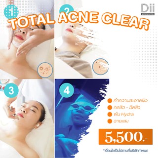 Dii Aesthetic : Total Acne Clear 1Time เคลียร์สิว 4 ขั้นตอน