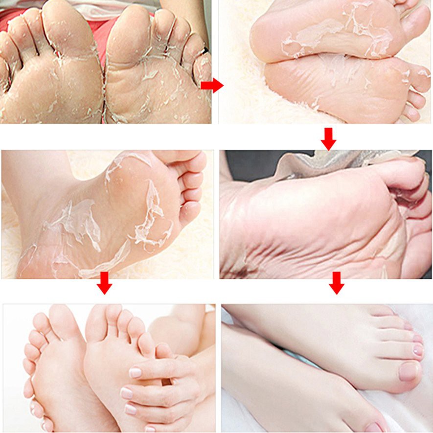 bys-efero-exfoliating-foot-mask-มาส์กลอกเท้า-ปรับเท้านุ่มเหมือนเท้าเด็ก-1-คู่-ถุง