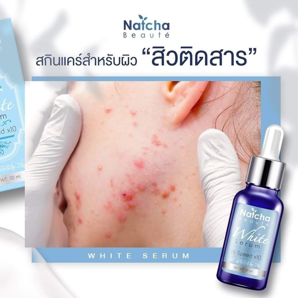 เซรั่ม-ณัชชา-สลายสิว-ฝ้า-กระ-จุดด่างดำ-ของแท้100-30ml-เลขที่จดแจ้ง-10-1-6100020039